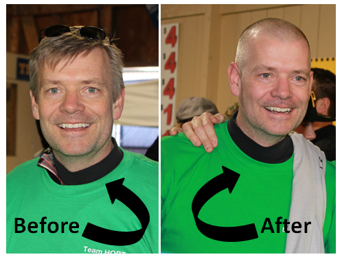 Dean_before_and_after