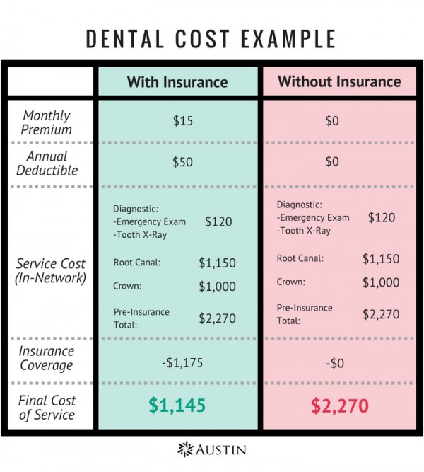 Dental Cost Example - Maria